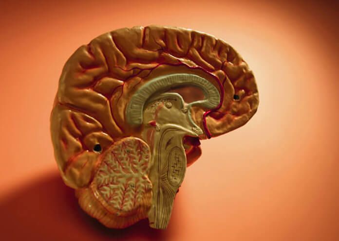 Model of a brain